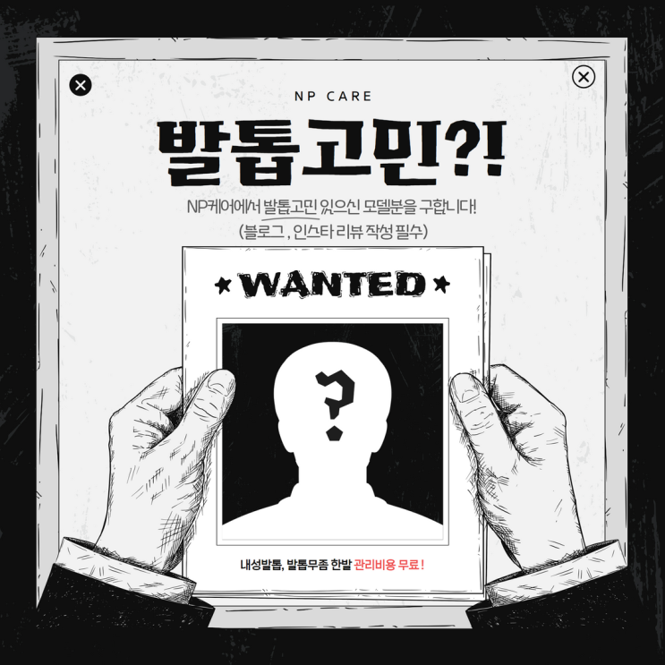  인천내성발톱, 인천무좀발톱 무료 이벤트 진행합니다