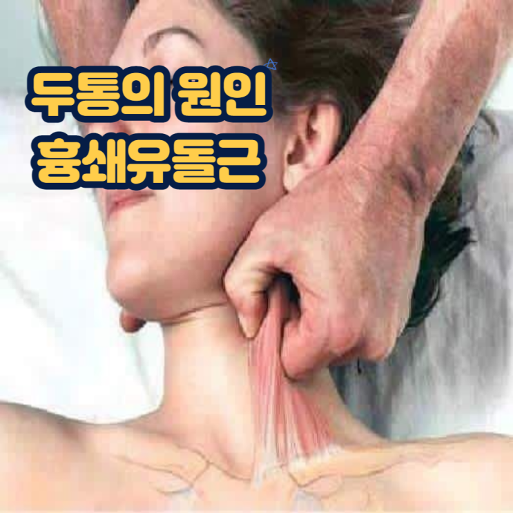 두통의 원인 흉쇄유돌근의 통증 및 방사통 & 마사지방법