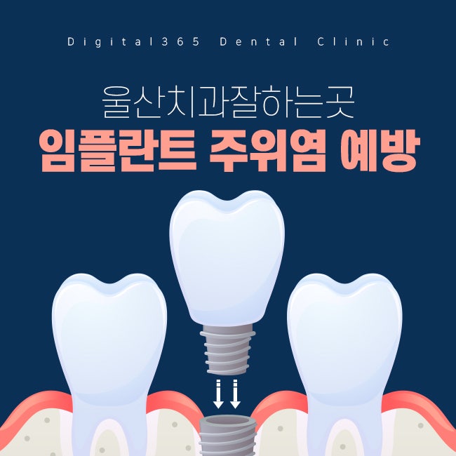  울산치과잘하는곳 임플란트 주위염 피해가려면?