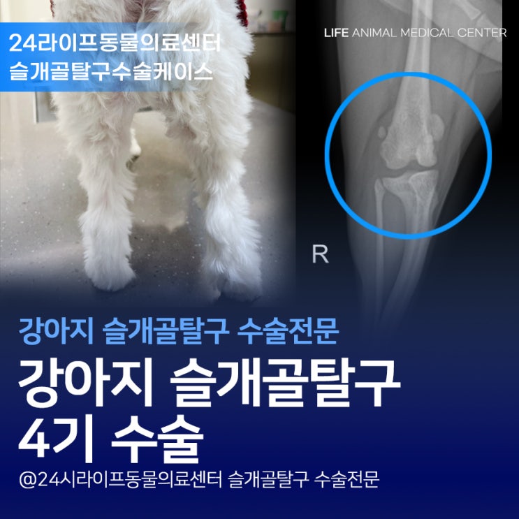 대구 강아지슬개골탈구4기수술 : 2살 말티즈 슬개골탈구양측수술 대구 강아지슬개골탈구4기수술 : 2살 말티즈 슬개골탈구양측수술