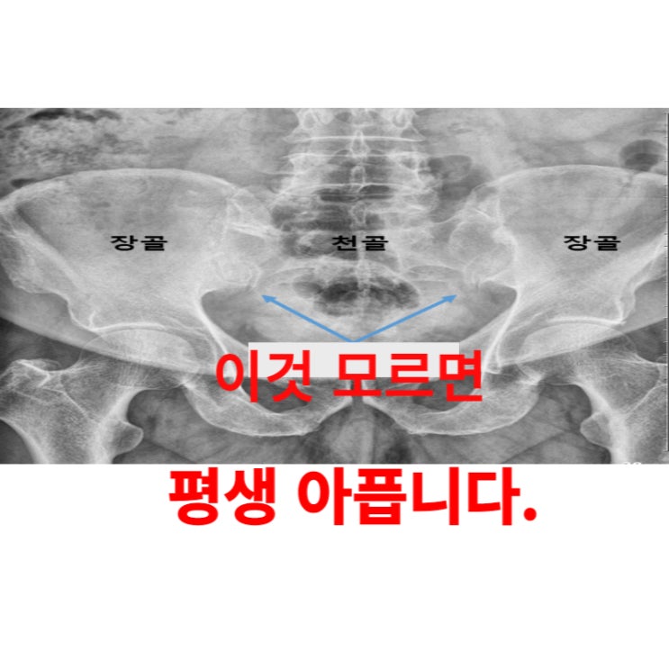  광주허리병원, 통증 이유를 모르시면 평생 아픕니다