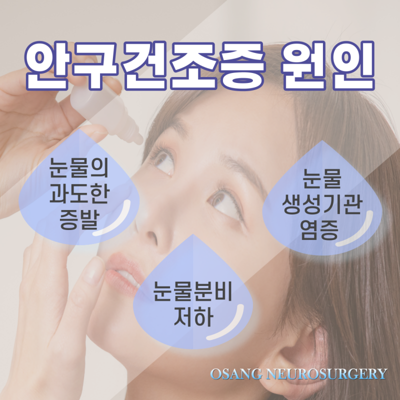 강남안구건조증 PRP안약 인공눈물 3
