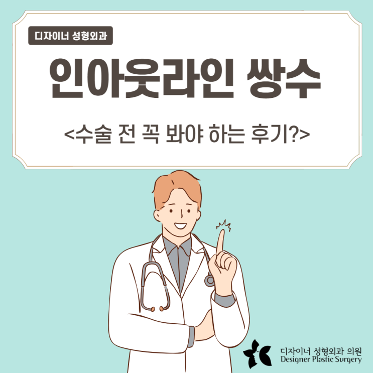  인아웃라인 쌍수 전에 반드시 확인해야 할 후기