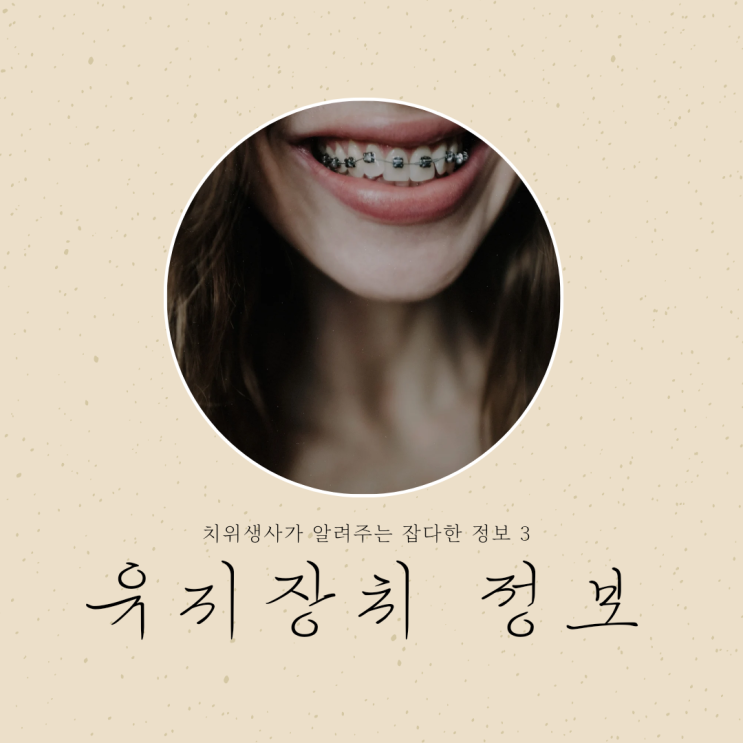 교정 유지장치에 대한 자주하는 질문 3가지