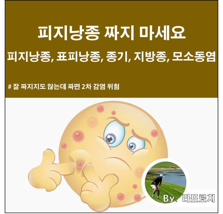  피지낭종 짜지마세요. 표피낭종 피지낭종 원인과 제거, 피지낭종 제거 후기