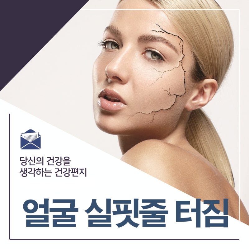 얼굴 실핏줄 터짐의 다양한 원인과 예방법