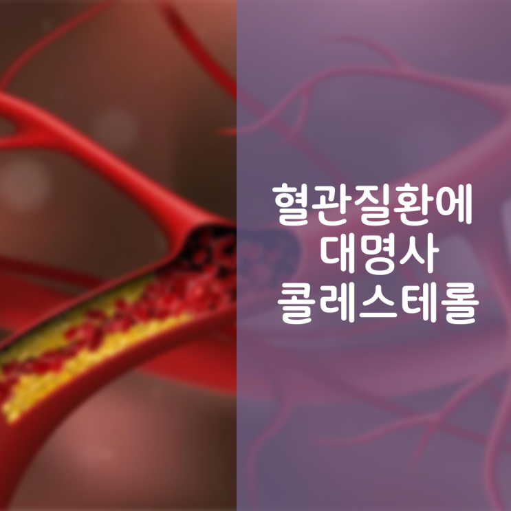  혈관질환에 대명사 콜레스테롤