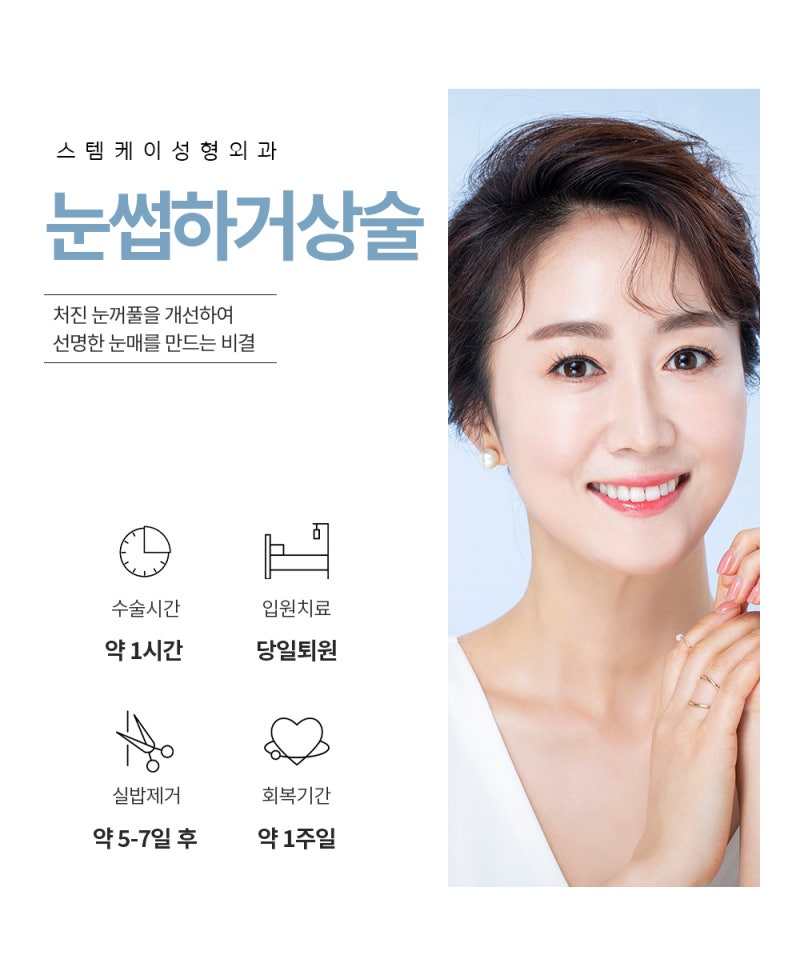 중년눈매교정 쌍꺼풀 라인을 잡아주는 2