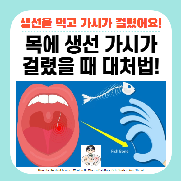  목에 생선 가시가 걸렸을 때 올바른 대처법!