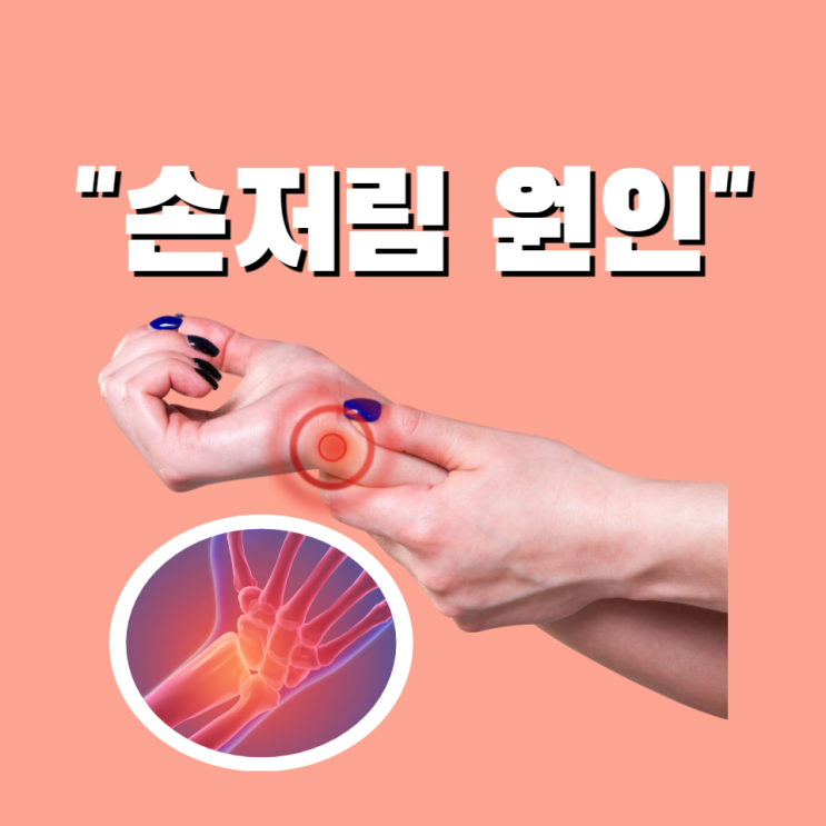 손저림 원인에 따른 증상 치료 방법 알아보고 해결해요 손저림 원인에 따른 증상 치료 방법 알아보고 해결해요