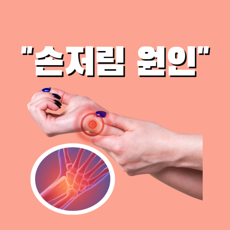 손저림 원인에 따른 증상 치료 방법 알아보고 해결해요