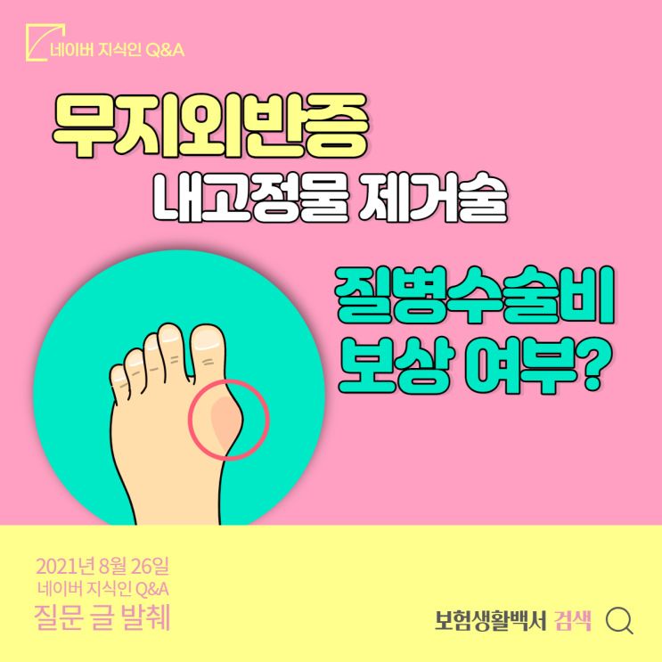  무지외반증 수술 이후 핀제거수술(내고정물제거술) 시 16대질병수술비 보상받을 수 있나요? – 네이버 지식인 Q&A