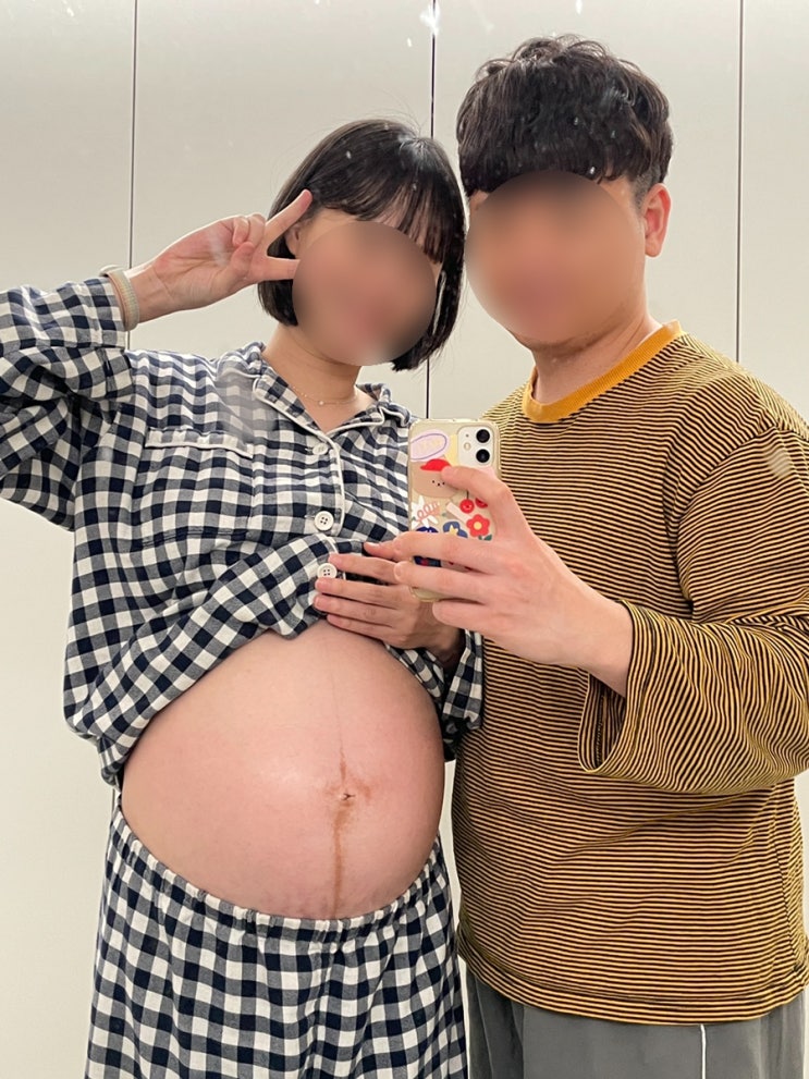  임신 28주차 증상일기(배뭉침, 자궁경부 길이, 임산부 축가, 튼살, 배크기, 속쓰림)