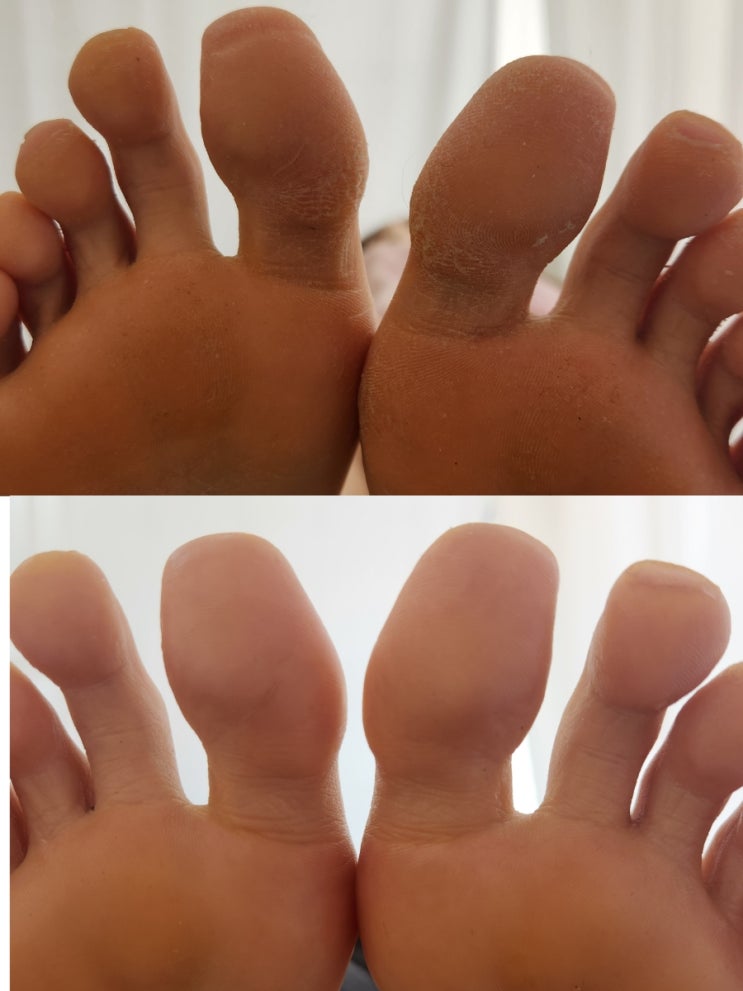  울산 북구 화봉동 발각질제거 패디플래닝