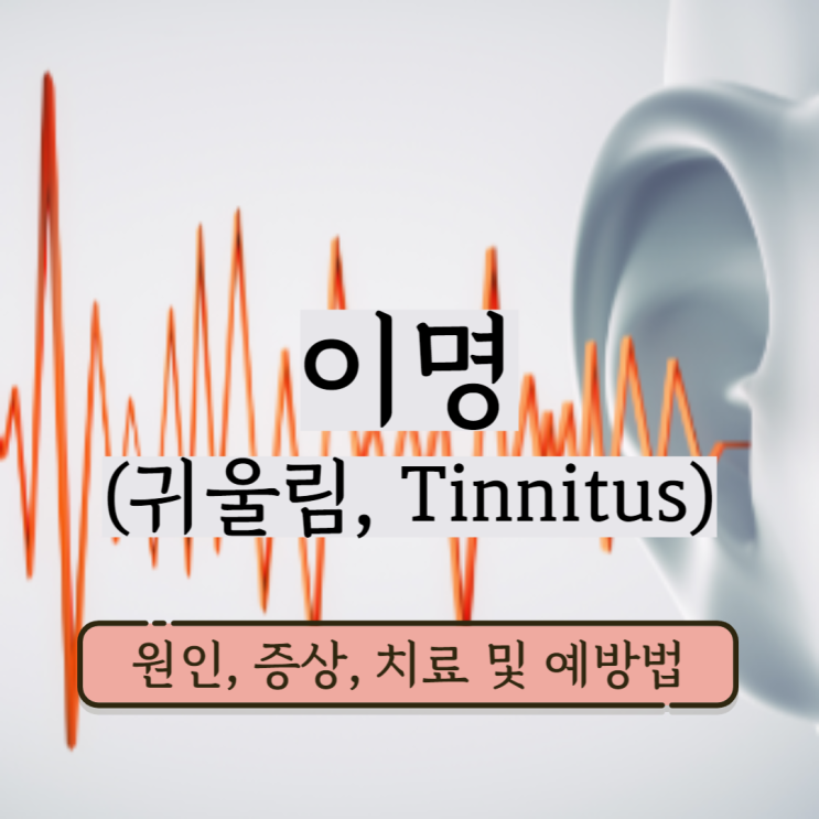 이명 귀에서삐소리 이명원인 귓속 이명 증상 치료 및 예방법 이명 귀에서삐소리 이명원인 귓속 이명 증상 치료 및 예방법