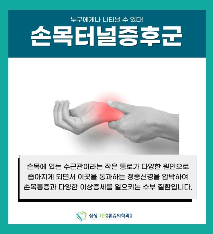  일산 마두 정형외과, 손목터널증후군 누구에게나 나타날 수 있어요! 증상은?