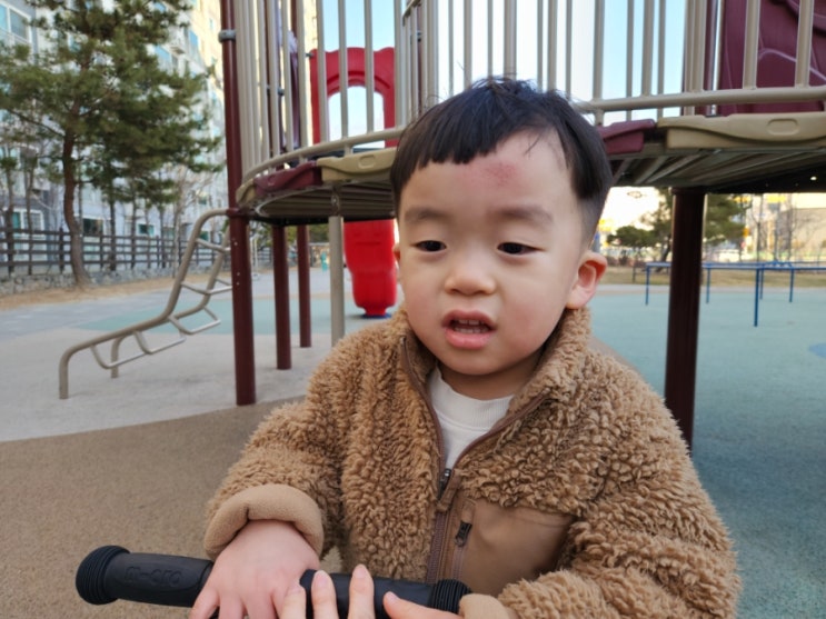  넘어져서 아이 이마 상처ㅠㅠ 그리고 상처패치(듀오덤)