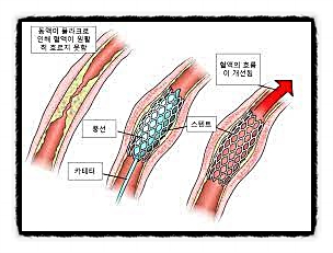  무턱대고 약을 꺼리는 태도를 버린다 목표 건강 유지 지식 필요