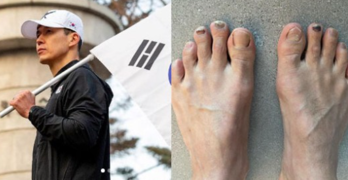 션, 3.1을 맞이 31km 달린다…"5개 발톱 성하지 않지만 최선을 다해" 션, 3.1을 맞이 31km 달린다…"5개 발톱 성하지 않지만 최선을 다해"