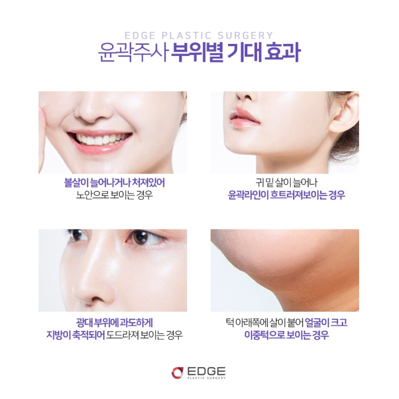 부드러운 선을 스캔하는 대구 외곽선