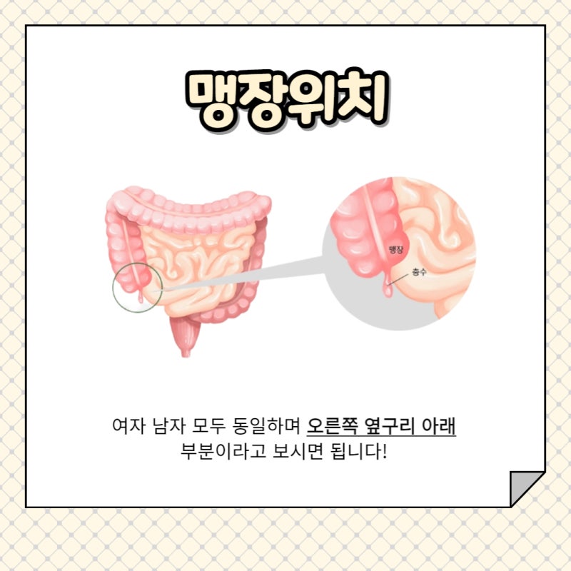 여자 남자 맹장위치 및 맹장염 초기증상 특징 정리 : 네이버 블로그