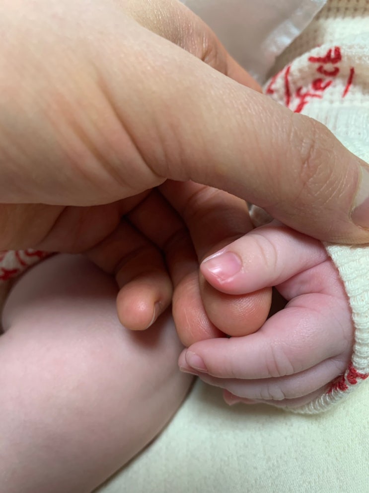 신생아 아기 손톱 자르기, 손톱 염증 생겼을때 관리 및 치료