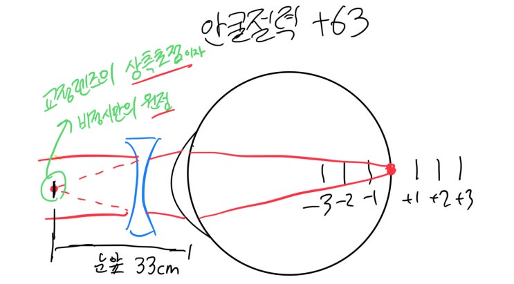  원점굴절도/굴절이상도와 안경 교정원리, 정간거리 보정에 대해 알아보자!