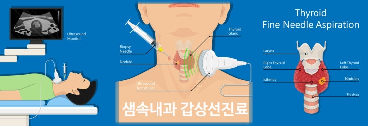  경산 하양 샘속내과 갑상선 초음파 및 갑상선 시술