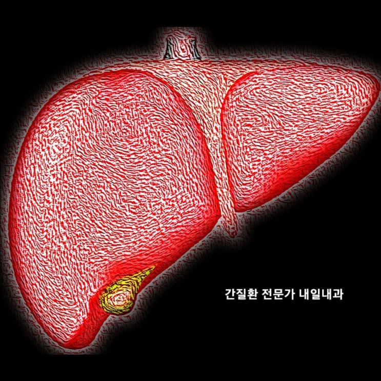  GOT, GPT가 높아요; AST, ALT 간기능 이상, 간질환 잘보는 시흥동 내과 (2)
