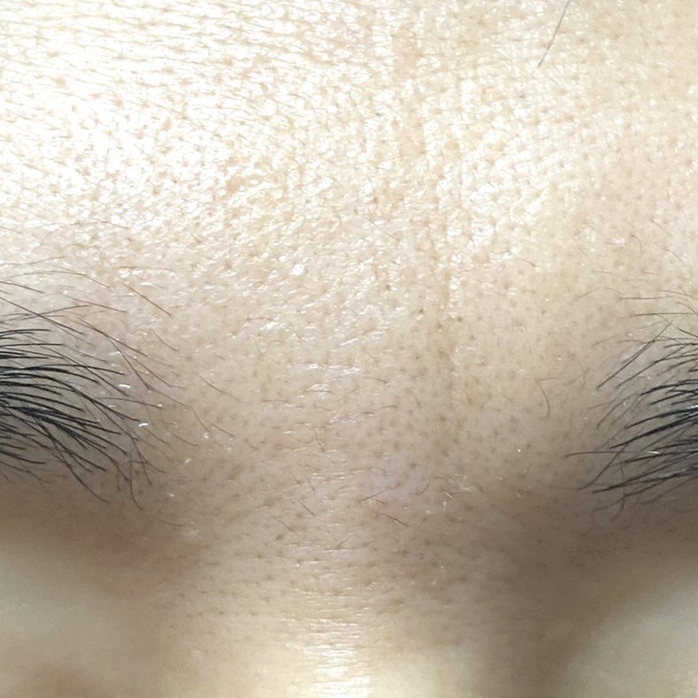 미간에 주름이 생겨서 산, 마르시끄 미간패치 : 네이버 블로그