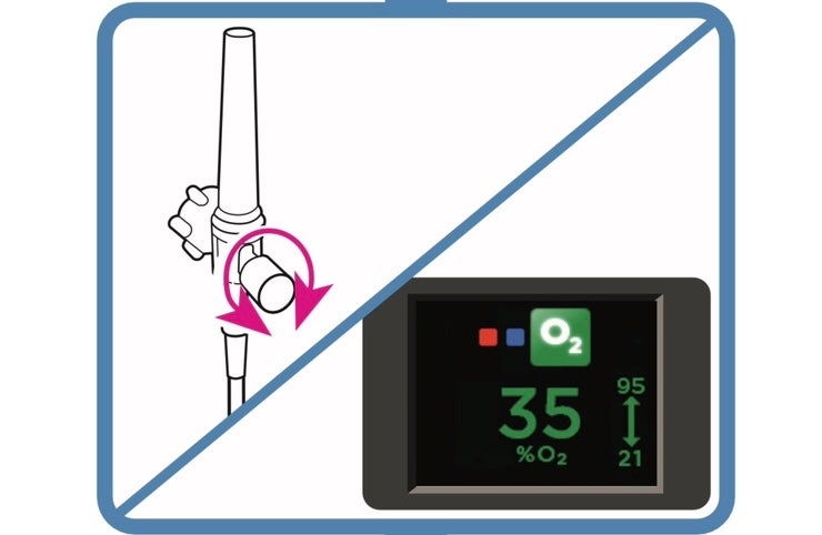 [ICU에서 공부하다] optiflow(Airvo, high flow) : 네이버 블로그