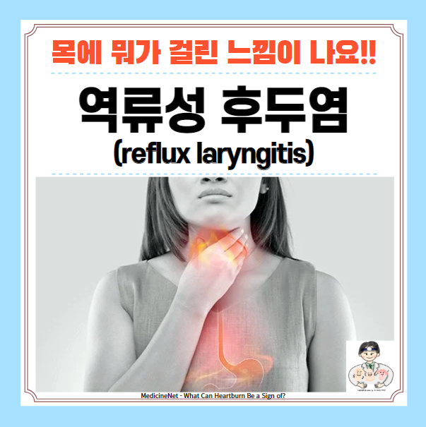  목에 뭐가 걸린느낌, 목에 가래낀 느낌 - 역류성 후두염(Reflux laryngitis), 인후두 역류 질환(LPRD)