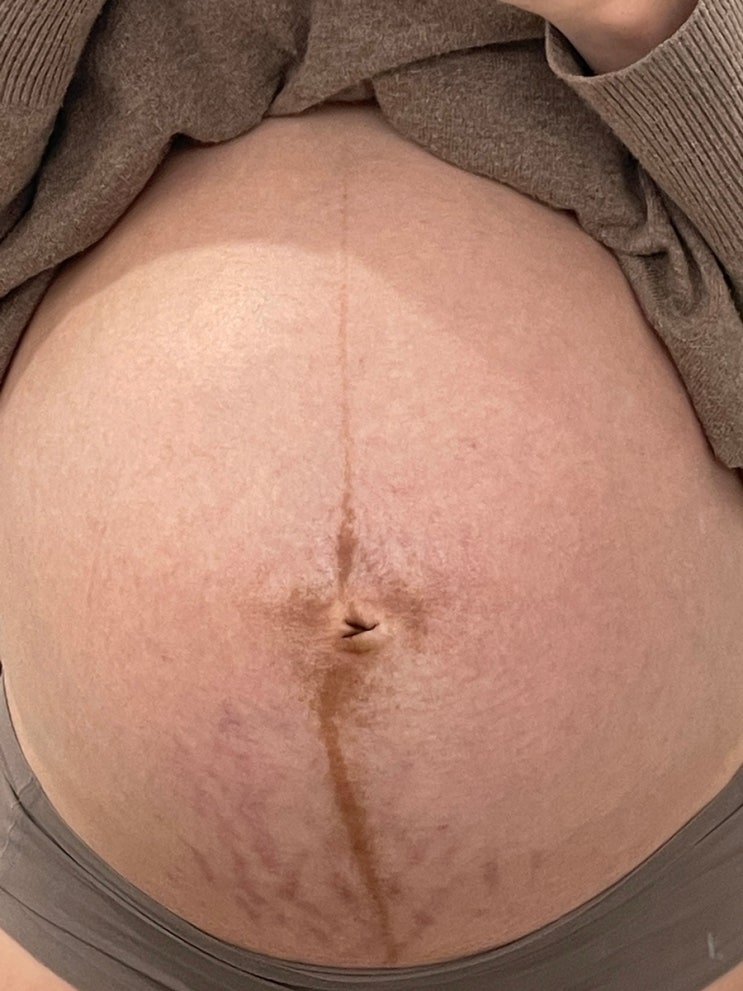 임신 30주차 증상일기(속쓰림, 튼살, 입덧, 낮잠, 양치덧, 임신선, 과자)