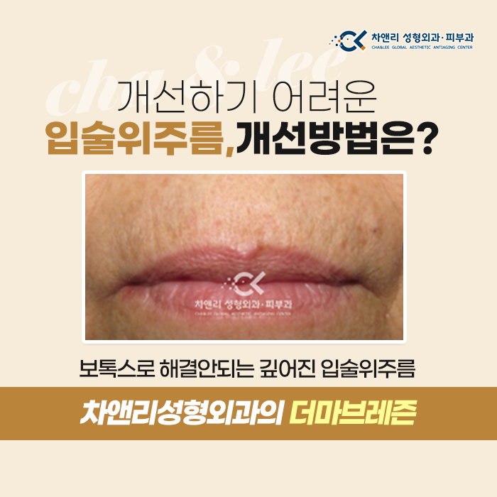  장년, 노년의 입술위 깊은주름