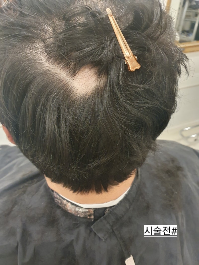 숱없는 남자머리 펌 잘하는곳 🤓 산뜻하겡 : 네이버 블로그, image size:800x1067
