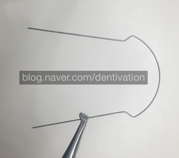 [치과 교정 재료] 모양부터 다른 설측교정용 철사 - 설측교정 와이어, 교정용 호선