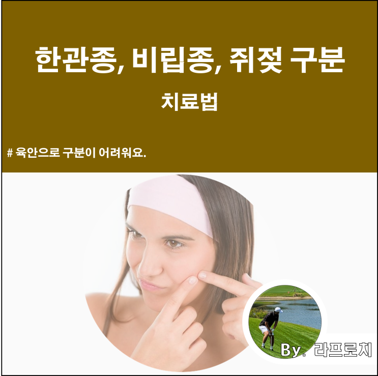  황관종 한관종, 비립종, 쥐젖 구분하기