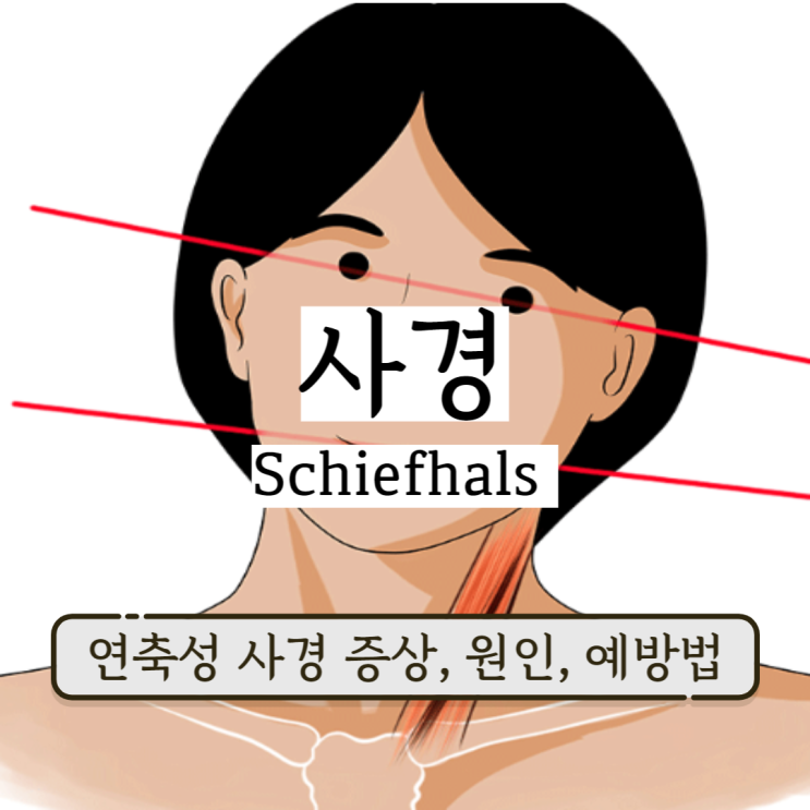 성인 사경 증상 원인 연축성 사경 예방하는 흉쇄유돌근 마사지 성인 사경 증상 원인 연축성 사경 예방하는 흉쇄유돌근 마사지