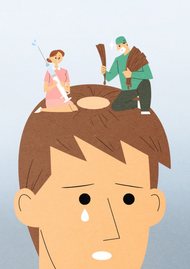 ‘청년 탈모’ 지원 나선 지자체…복지냐 포퓰리즘이냐 ‘청년 탈모’ 지원 나선 지자체…복지냐 포퓰리즘이냐
