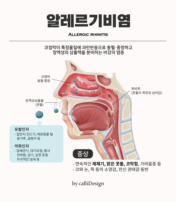  알레르기비염 정복하기(ft.봄의 시작) [청주율량동더바른한의원]