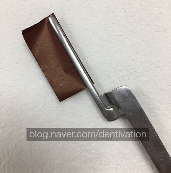  치과에서 "이 딱딱 씹어보세요" 하는건 뭐에요? 치아가 잘 닿나 확인하는 교합지, 심스탁