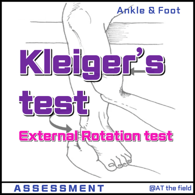 Kleiger’s test(external rotation test)/ 클레이거 검사/경비간인대, syndesmosis 검사, 발목 내측인대 검사, High ankle sprain