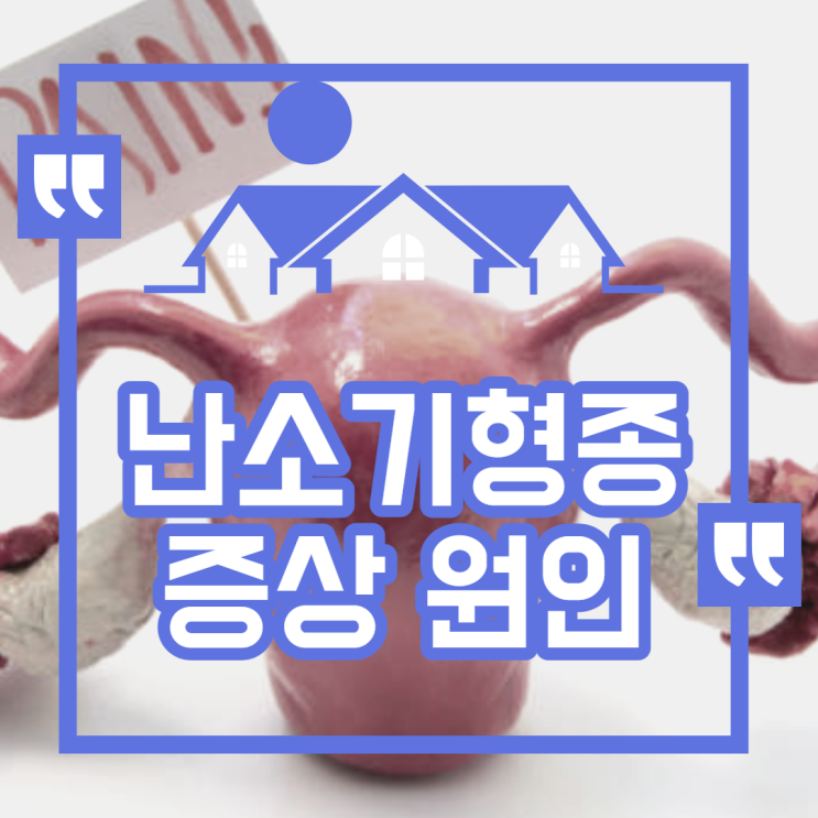  난소기형종 증상, 원인 및 수술