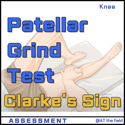 Patellar Grind Test(Clarke's sign) /클라크 징후,슬개대퇴통증증후군,PFPS,연골연화증,무릎이학적검사