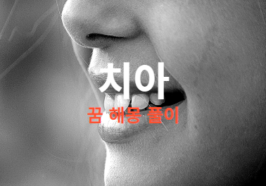  이가 빠지는 꿈은 정말 흉몽 이네요? 특히 윗니 아랫니 ?