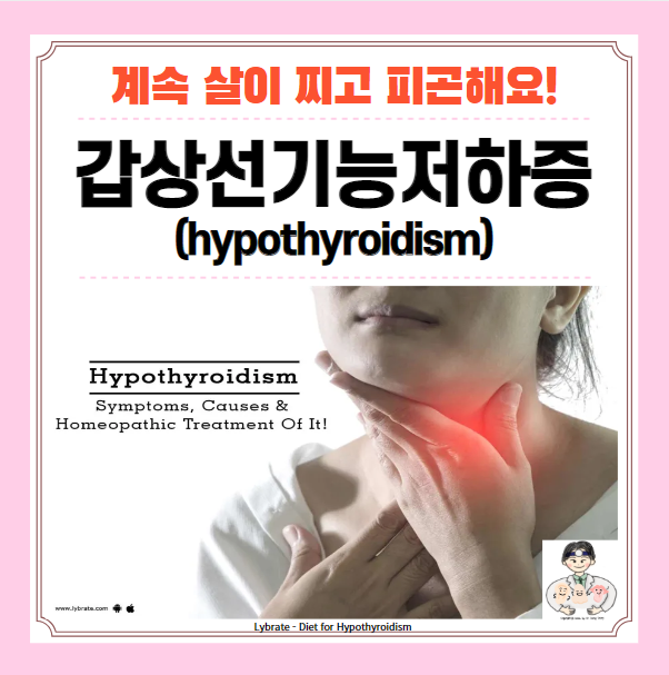  갑상선기능저하증(갑상샘 저하증, Hypothyroidism) 원인, 증상, 진단, 치료