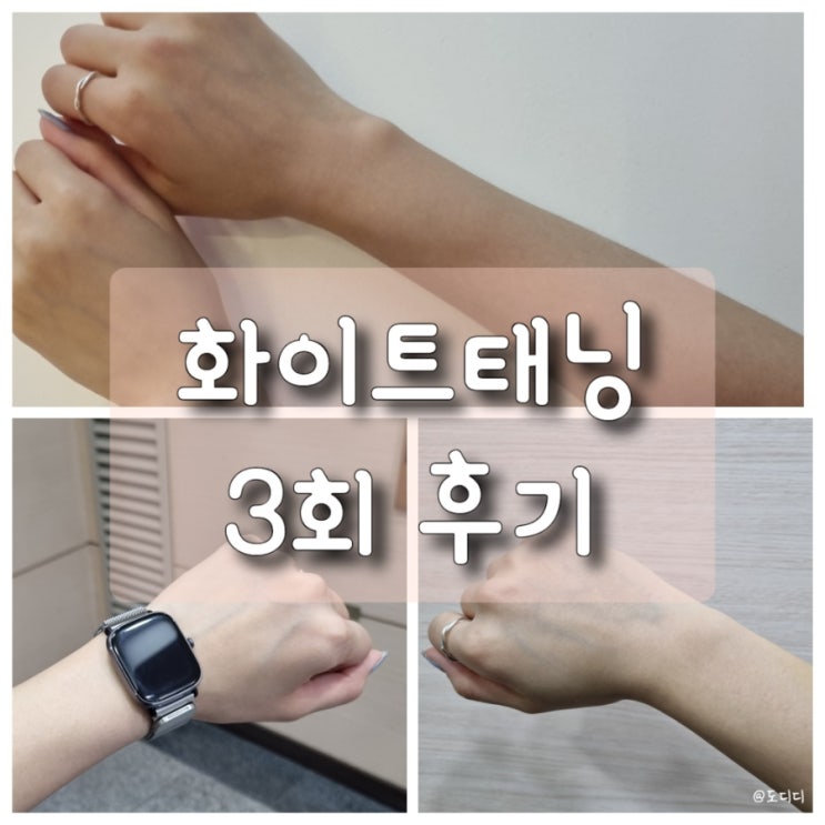  10주년 태닝샵 탠몬스터 강남 화이트태닝 3회 후기, 테닝샵 이벤트