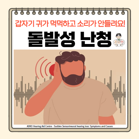  돌발성 난청 원인 및 증상, 진단, 치료 - 귀가 먹먹해요