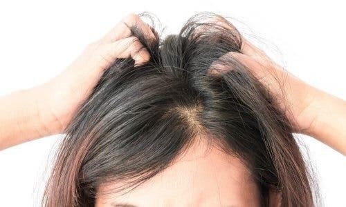 비듬 꿈 머리에 비듬 꿈 머리비듬꿈해몽 비듬떨어지는꿈해몽 비듬꿈해몽