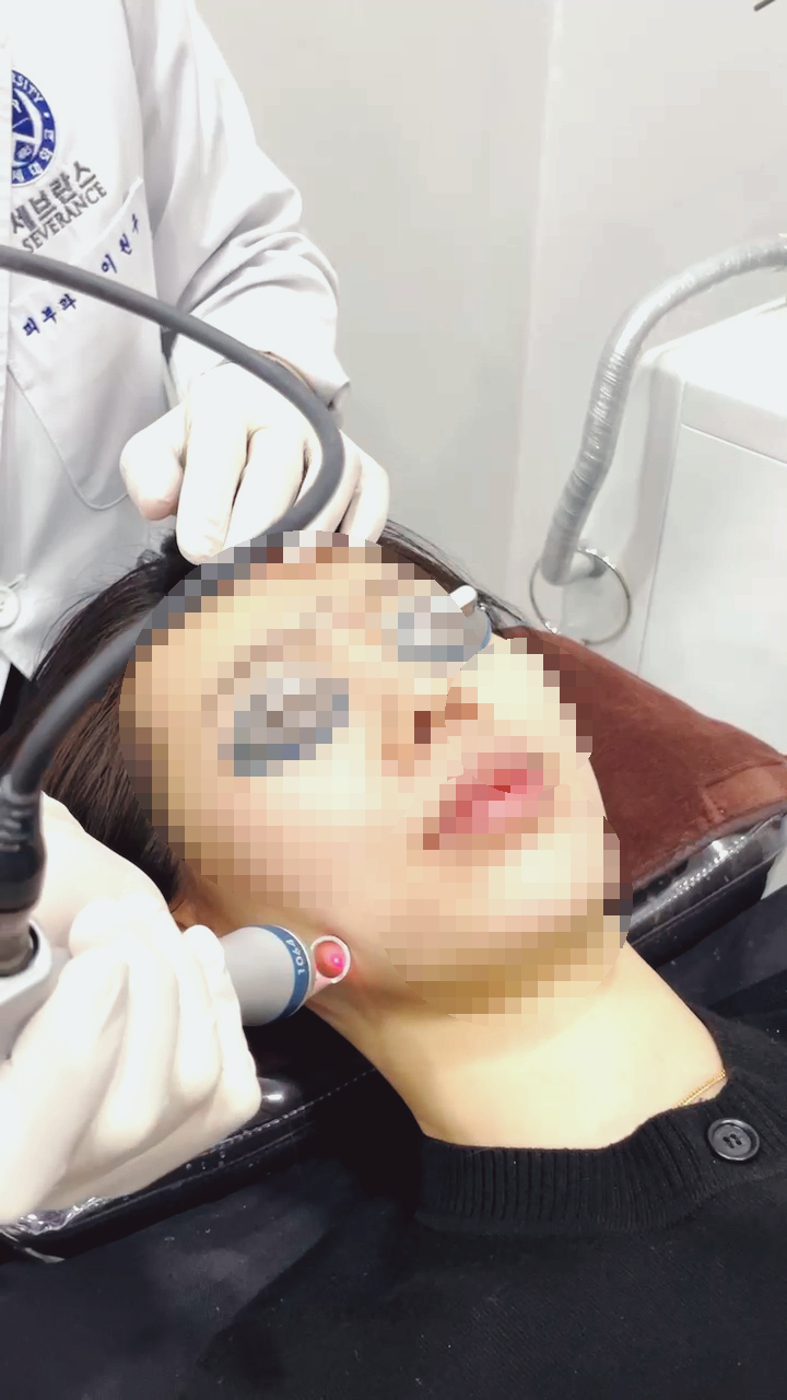 해운대 센텀 피코 프락셀로 기미 잡티제거 해운대 센텀 피코 프락셀로 기미 잡티제거